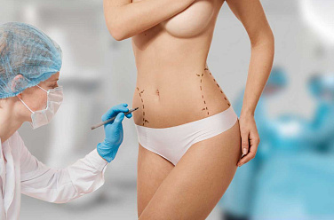 woman_marked_out_cosmetic_surgery