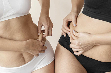 close_up_women_holding_skin