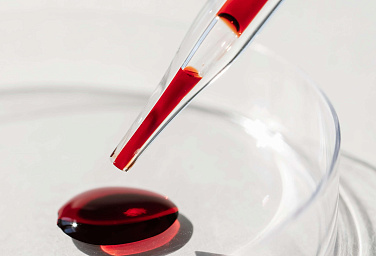 В «Скандинавии» ведут прием кардиологи-липидологи