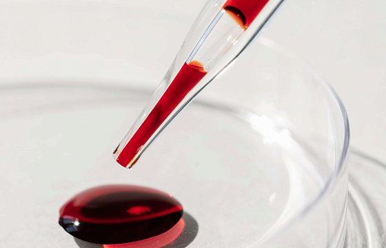 В «Скандинавии» ведут прием кардиологи-липидологи